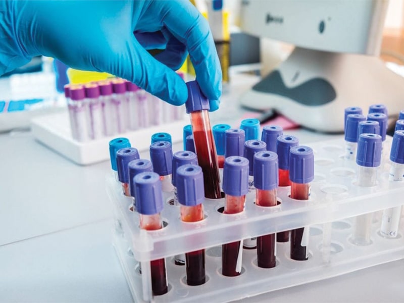 Visualizza la notizia: nùmeru nou de su telèfunu po prenotai is esàminis de laboratòriu. Visualizza la notizia: nùmeru nou de su telèfunu po prenotai is esàminis de laboratòriu.