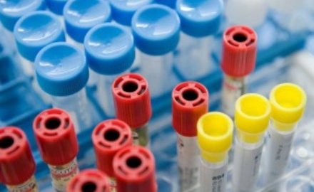 Visualizza la notizia: Chiusura estiva del centro prelievi di Sardara Visualizza la notizia: Chiusura estiva del centro prelievi di Sardara