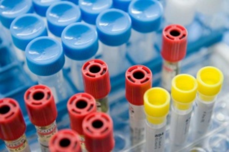 Chiusura laboratorio